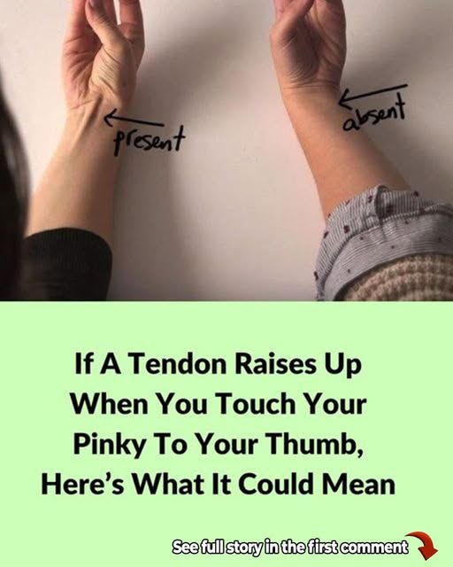 If a Tendon Raises Up When You Touch Your Pinky to Your Thumb, Here’s What It Could Mean