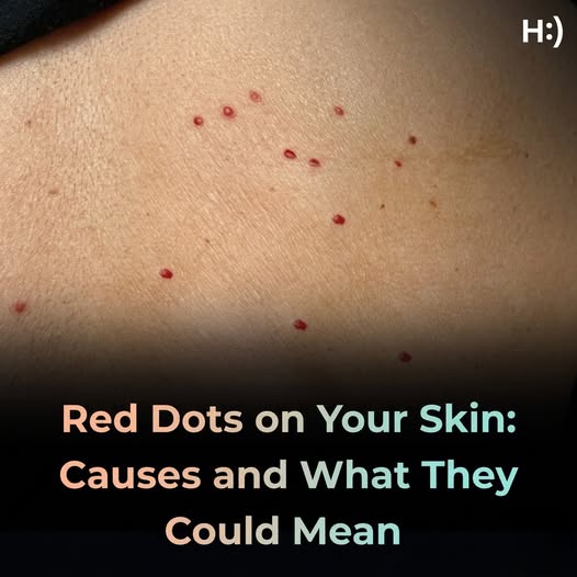 Red dots on your skin: Causes and what they could mean