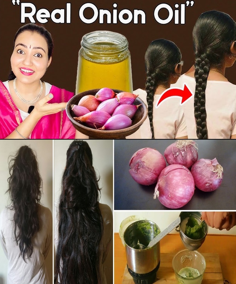 How to Make Onion Hair Oil for Faster Hair Growth and to Stop Hair Fall