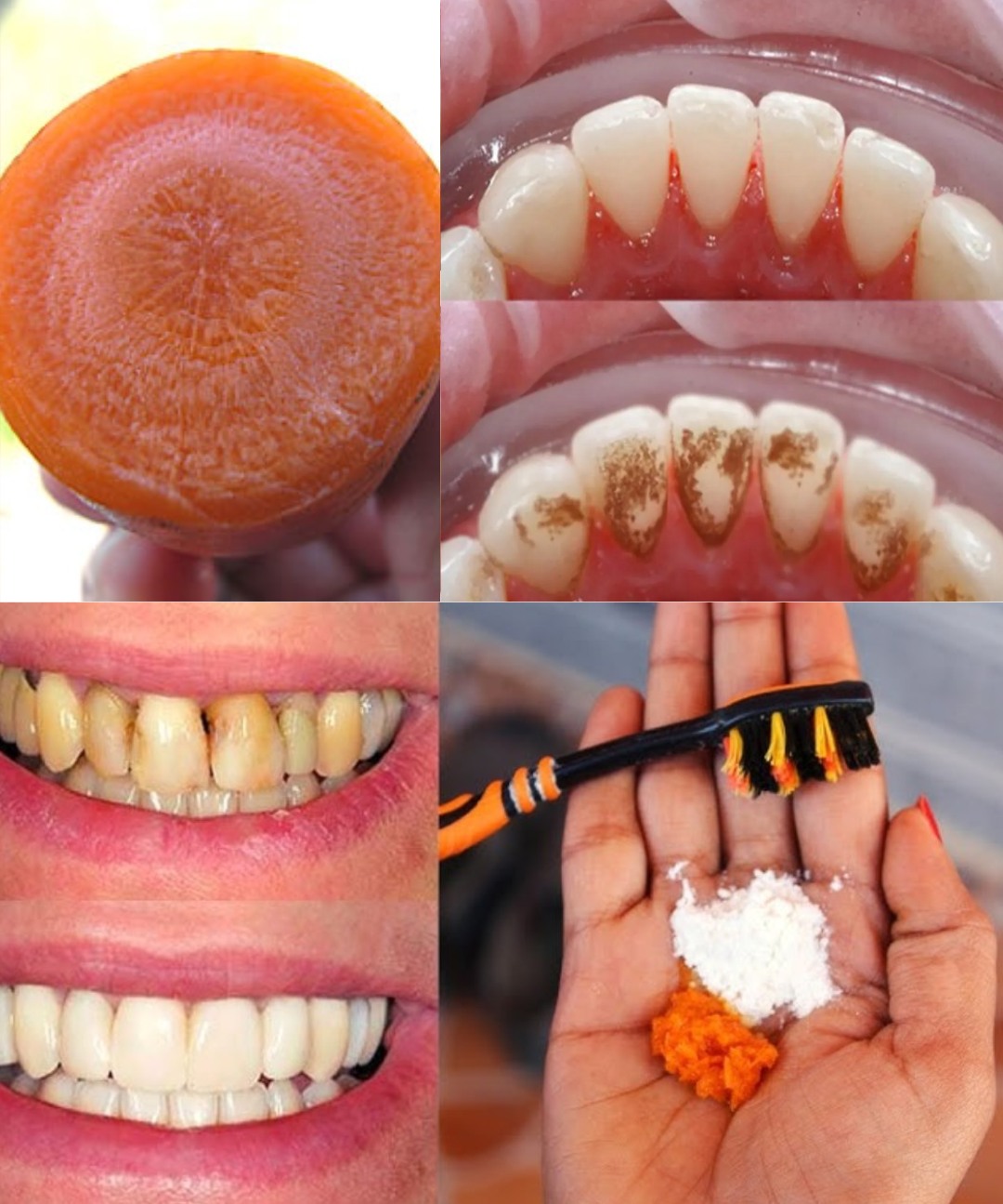 Brighten Your Smile Naturally with… Carrot Tops? Yes, Really!