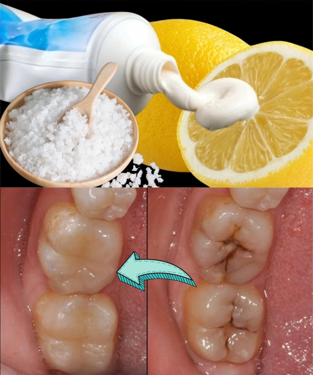 Can You Naturally Support Early Tooth Decay? Here’s What You Should Know