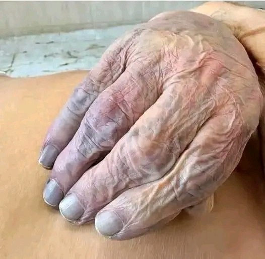 Women Who Have Hands Like This Often Share One Powerful Life Story