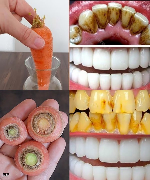 Carrot Tops: A Natural Remedy for a Brighter, Healthier Smile