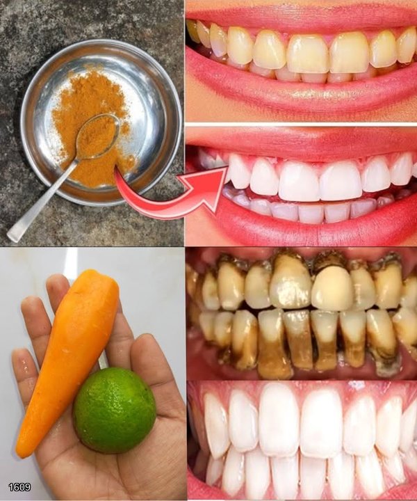 Whiten Your Teeth Naturally with Carrot Tops (Yes, Really!)