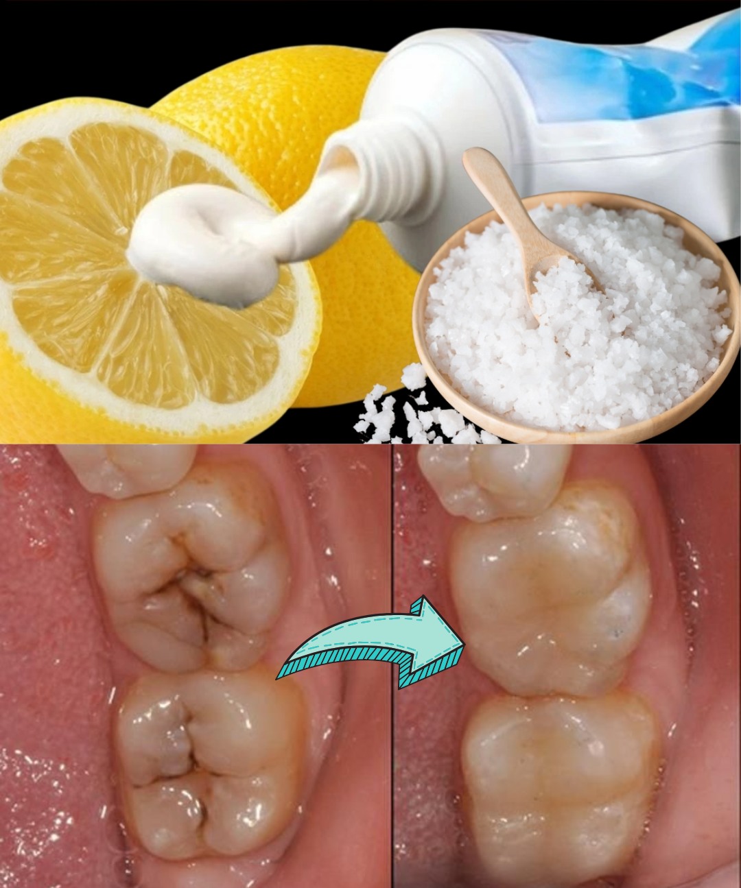 🦷 Naturally Nurture Your Smile: 6 Gentle Ways to Support Early Cavity Healing