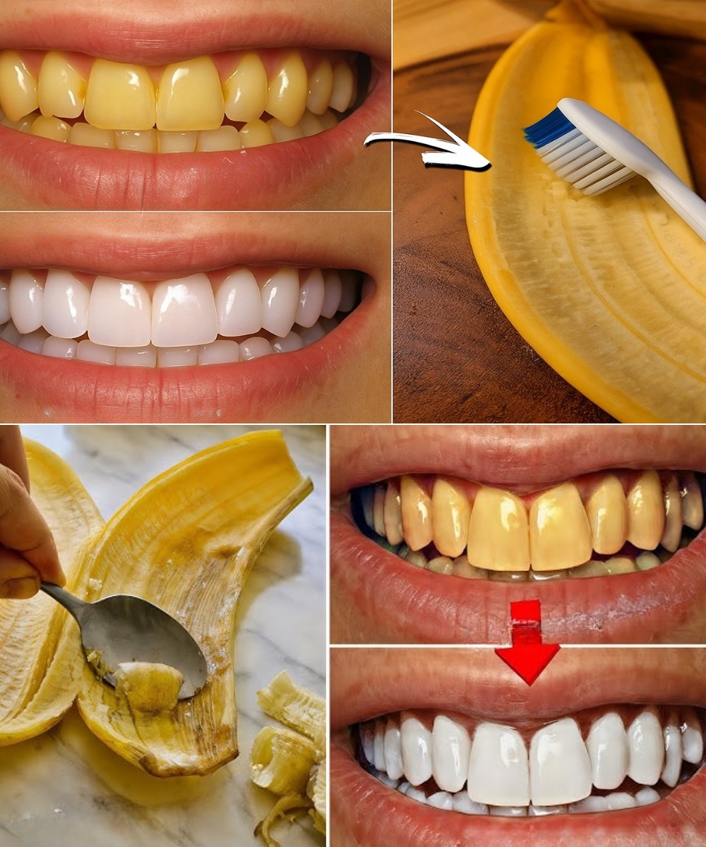 Before You Throw Away Banana Peels: The Secret Dentists Don’t Want You to Know – It Whitens Teeth in Just 2 Minutes!