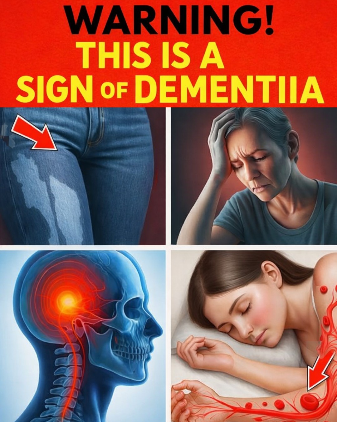 9 Early Signs of Dementia Few People Notice (and 13 Classic Symptoms You Should Never Ignore)