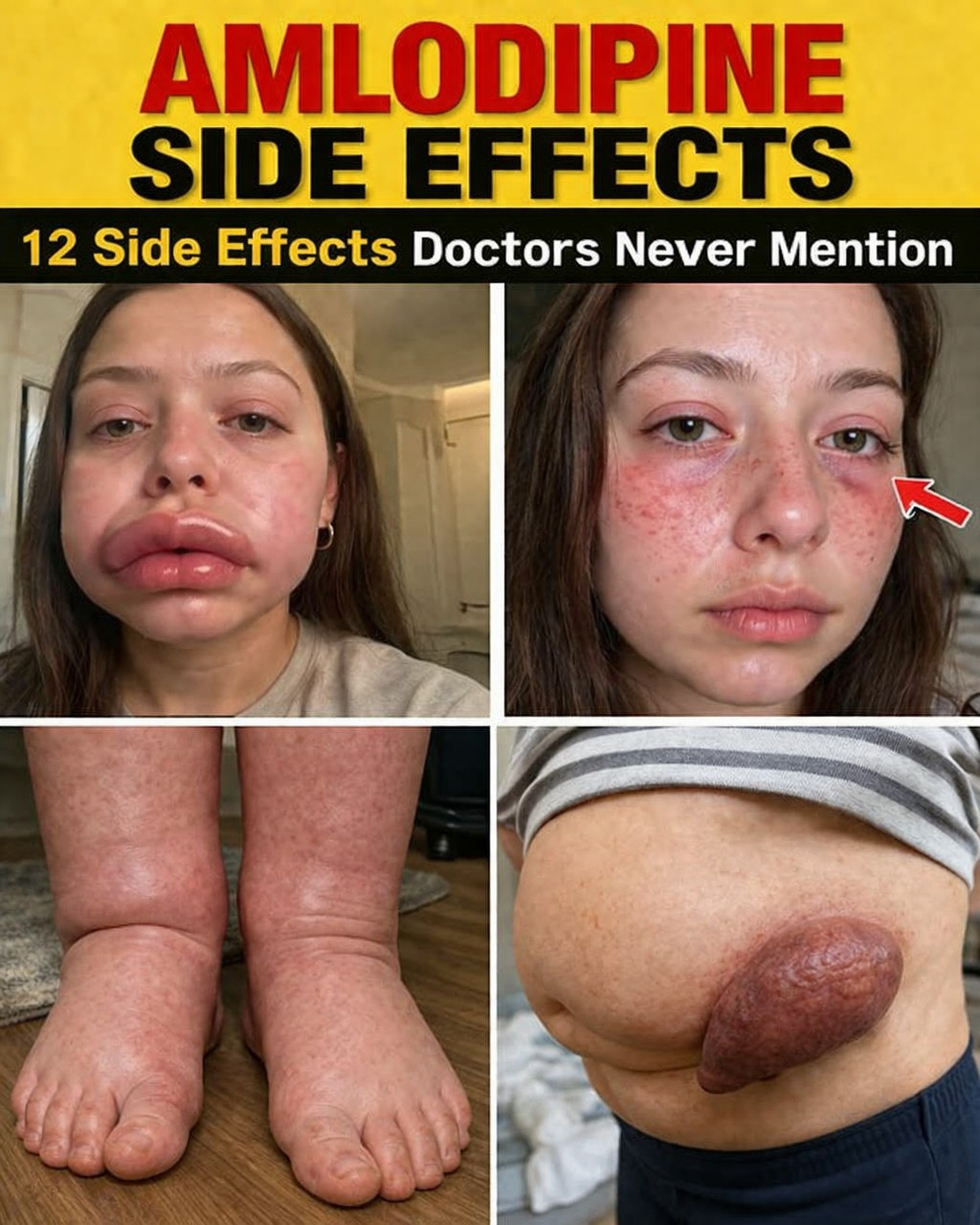 Amlodipine warnings you need to know now. Safety first!