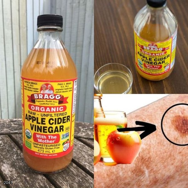 The Natural Way to Brighten Your Skin: Apple Cider Vinegar