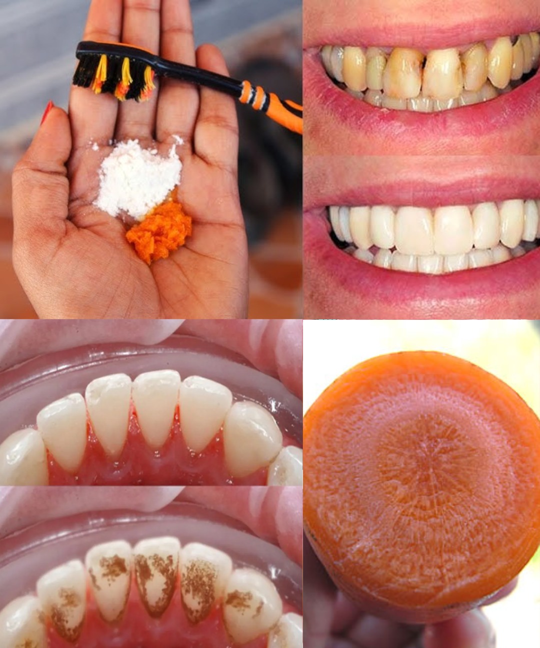 🥕 Whiten Your Teeth Naturally in Just 2 Minutes a Day—With Carrot Tops!