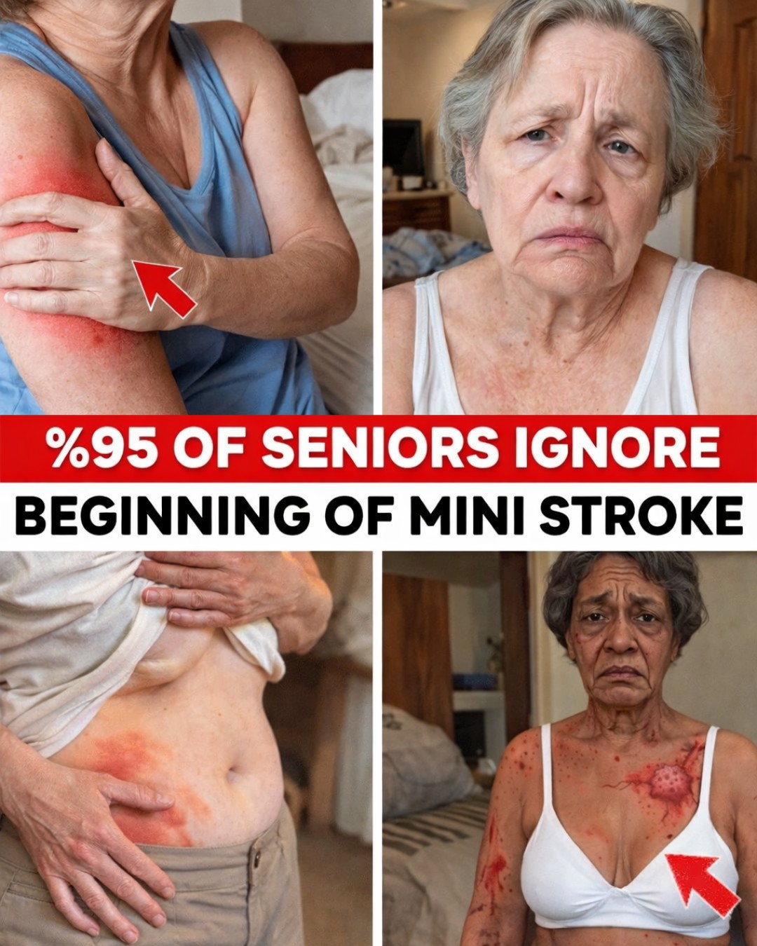 OVER 60: 10 Silent Mini Stroke Symptoms (Most People Miss #4)
