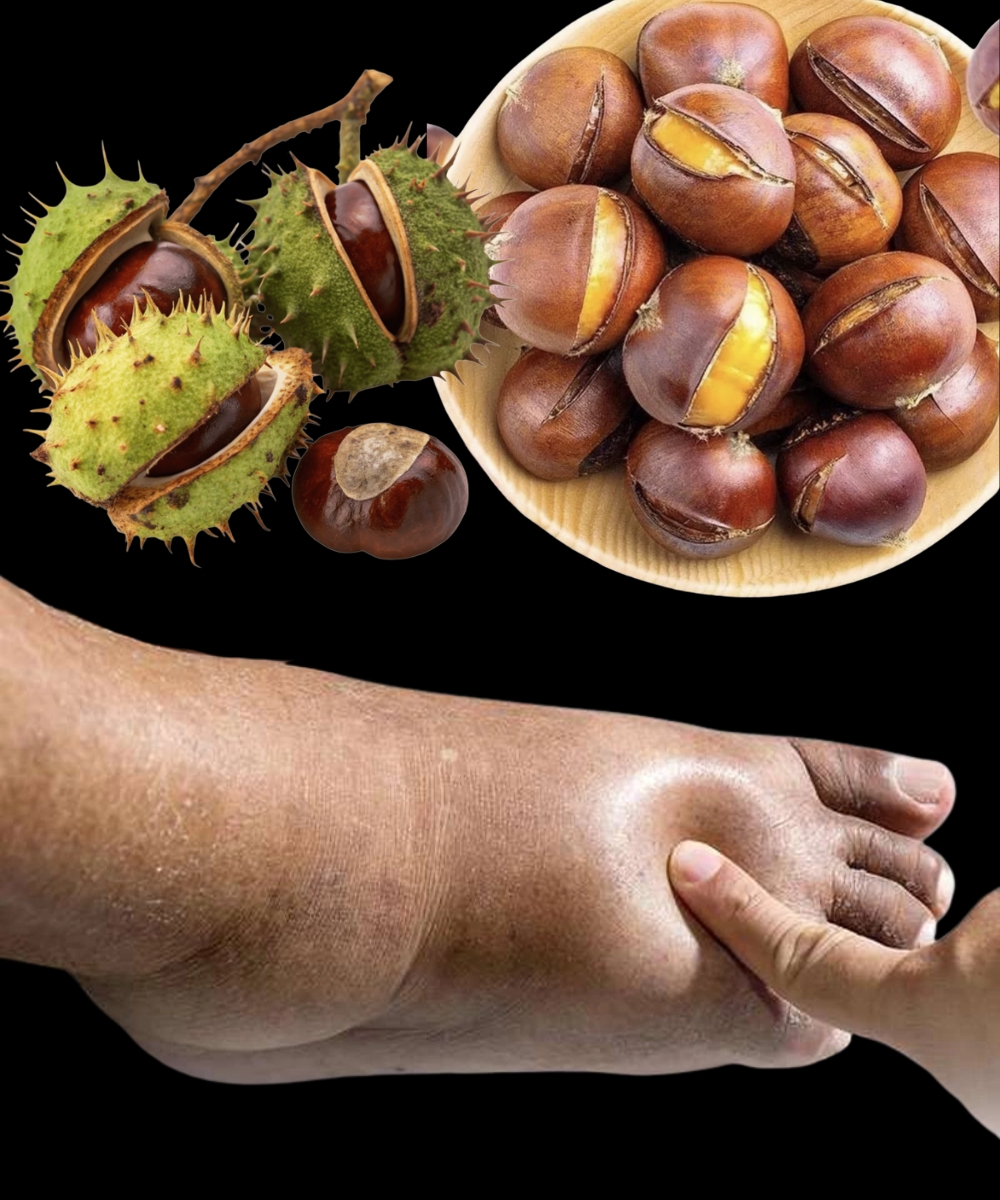 Horse Chestnut: The Strongest Natural Remedy for Swollen Legs and More…