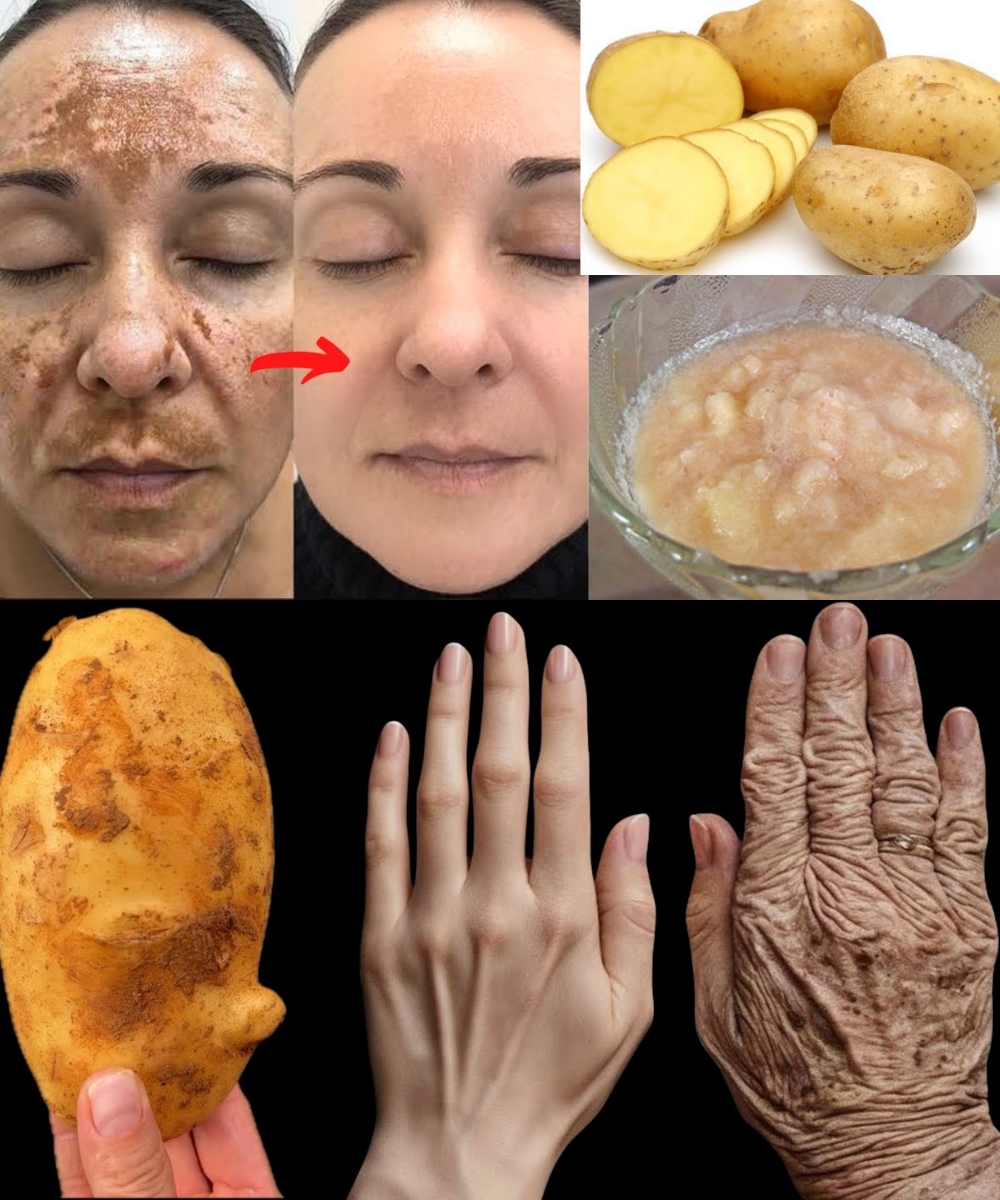 Remove Dark Spots and Wrinkles in 5 Minutes with This Simple Potato and Ginger Remedy