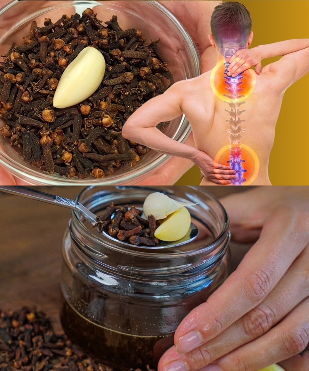 Say Goodbye to Joint Pain, Arthritis, and Rheumatism in Just 3 Days – Try This Potent Clove and Garlic Remedy!