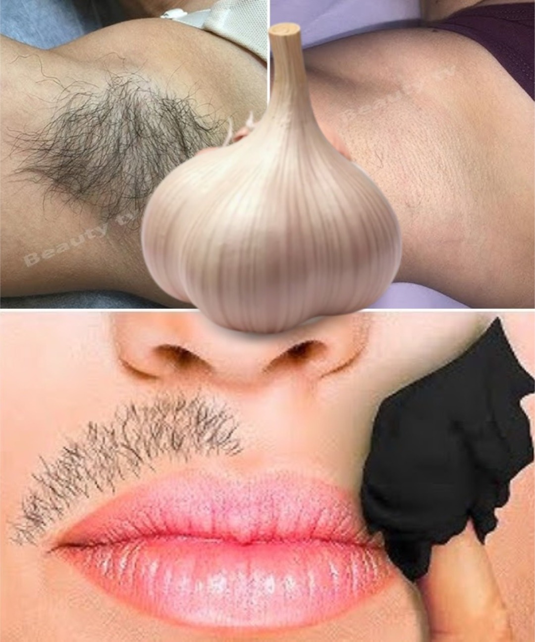 Say Goodbye to Shaving: 3 Natural Ways to Permanently Remove Unwanted Hair