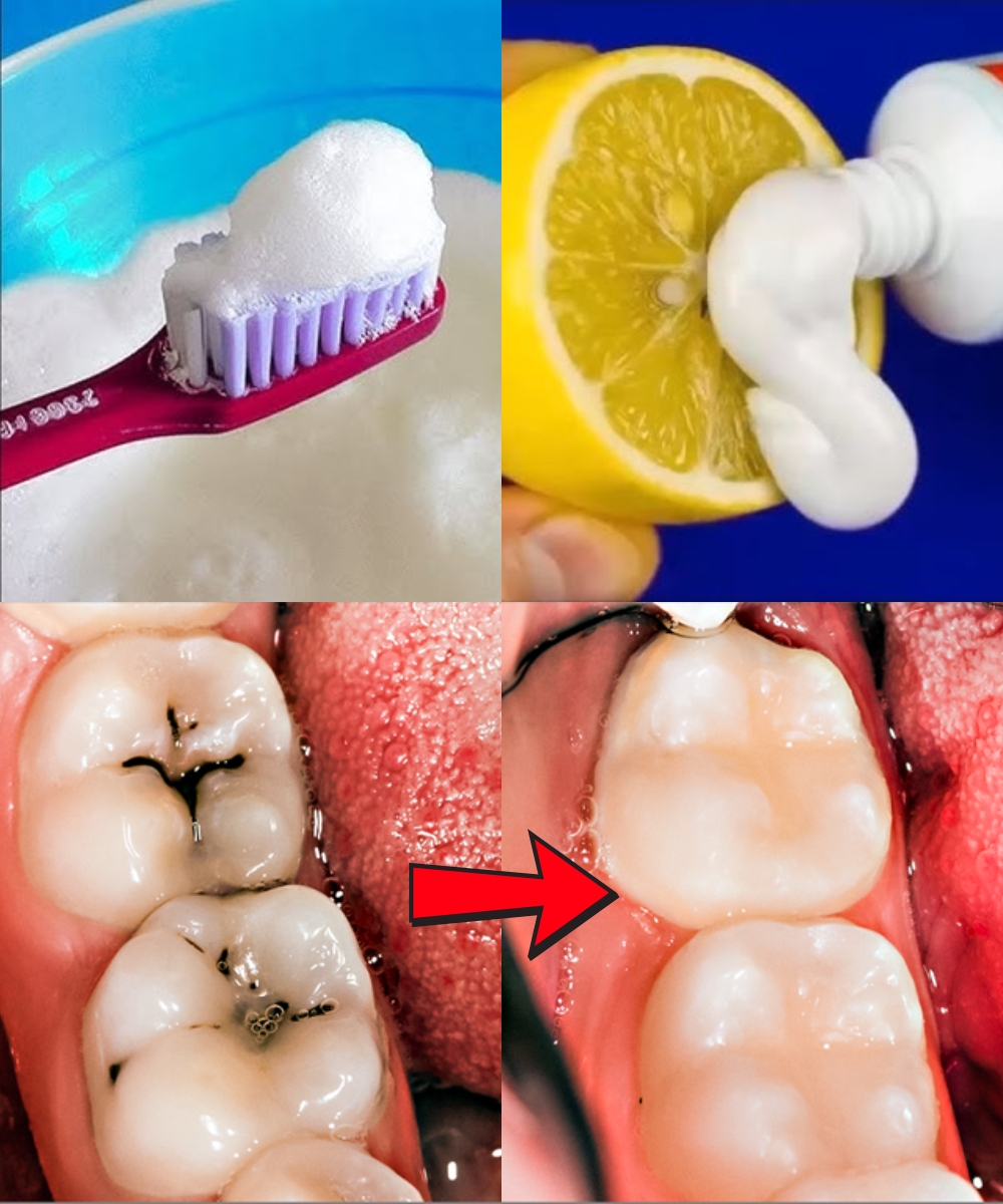 Natural Ways to Help Prevent Cavities and Strengthen Your Teeth