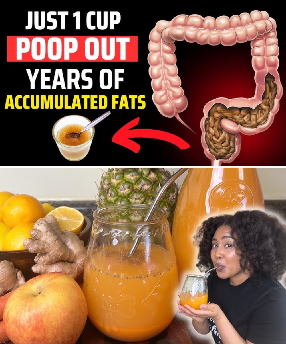 SHOCK! Drink These 8 Morning Drinks to Poop Out TOXIC FATS Stored for Years