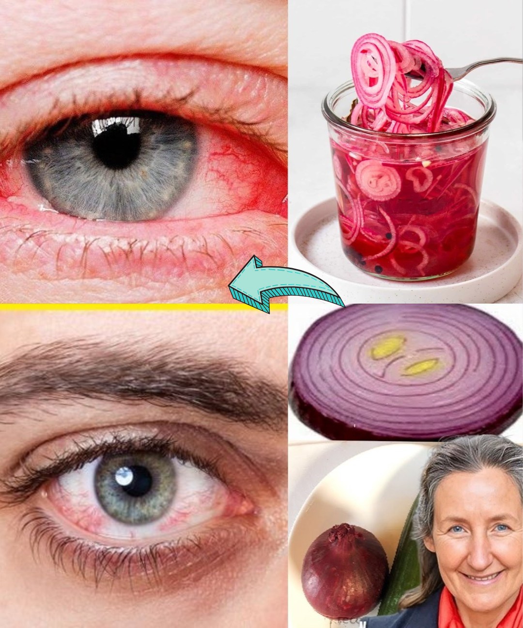 Can Onion Juice Really Improve Your Vision? Here’s What You Need to Know