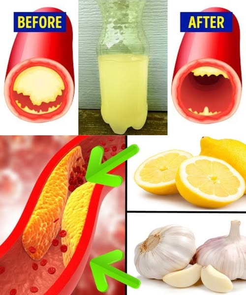 Garlic & Lemon: The Natural Power Duo That Lowers Cholesterol and Tackles 10 Surprising Health Issues