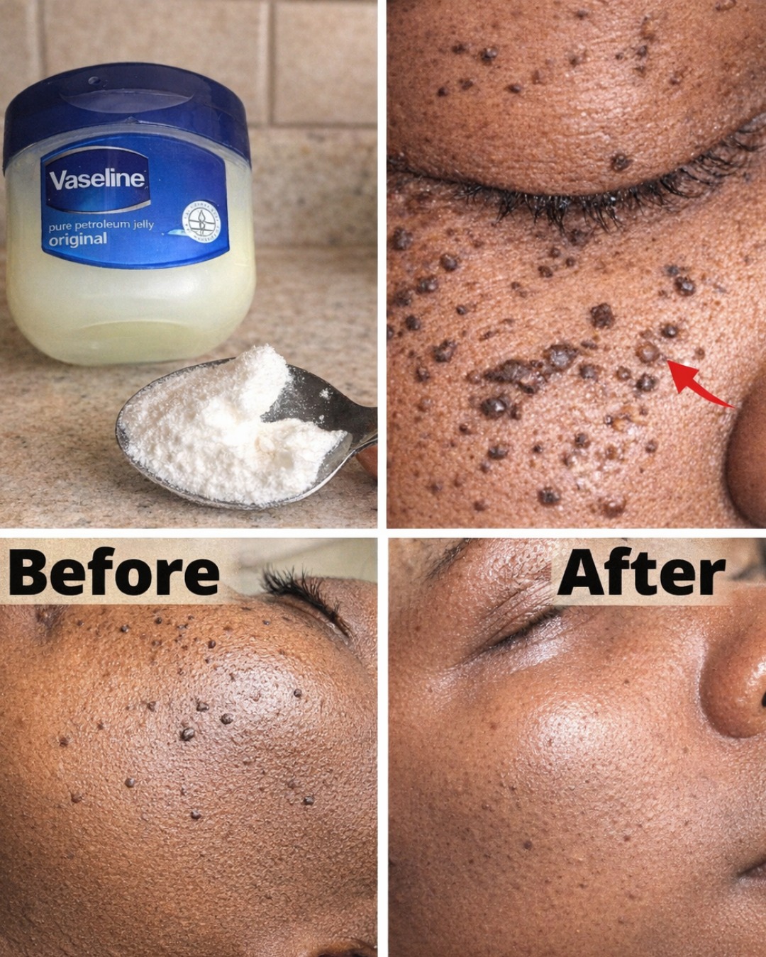 Tiny White Bumps on Your Face After 40 What Are They Really Telling You