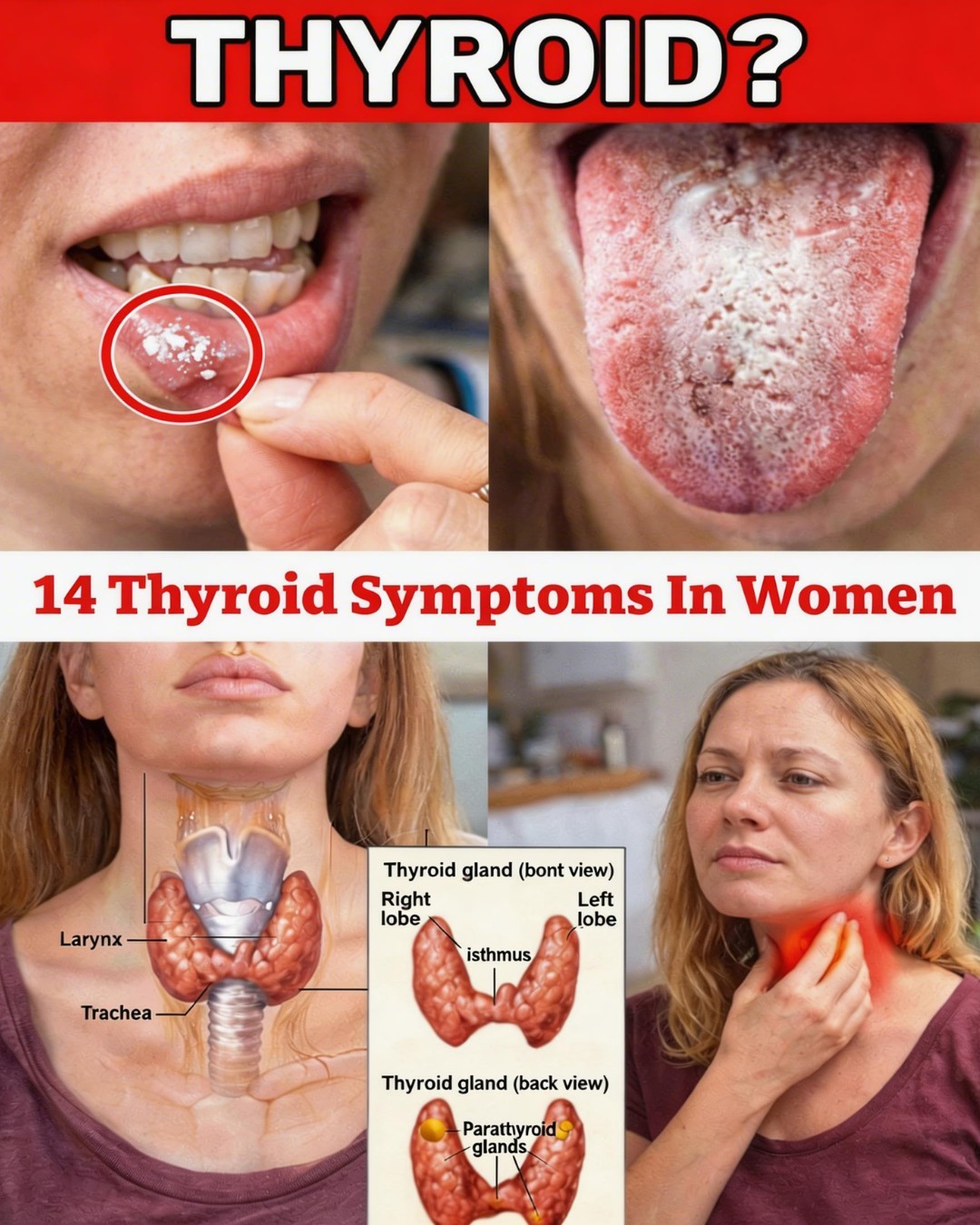 14 Thyroid Symptoms in Women You Should Never Ignore