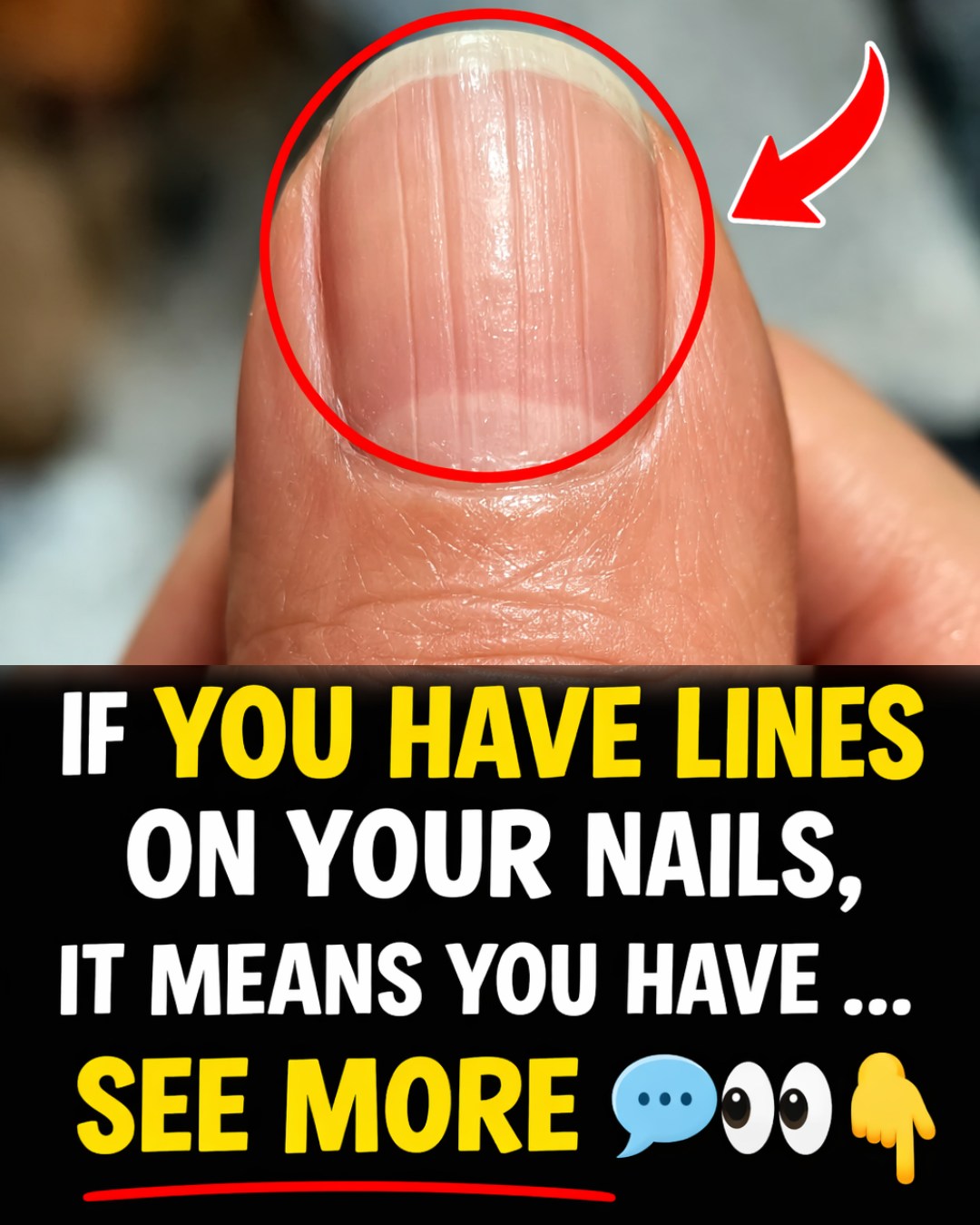 Lines on Your Fingernails: What They Could Mean and Simple Daily Habits to Support Healthier Nails