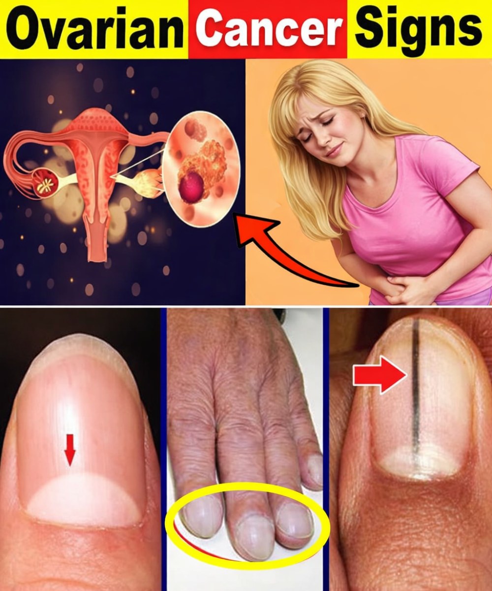 Women: Don’t Ignore These 14 Hidden Cancer Signals That Could Save Lives
