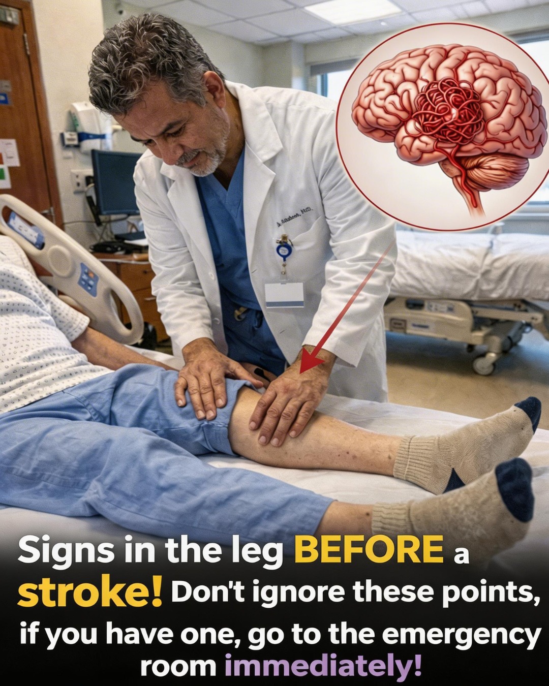 How to Recognize Leg Symptoms That Might Indicate a Higher Risk of Stroke in Older Adults