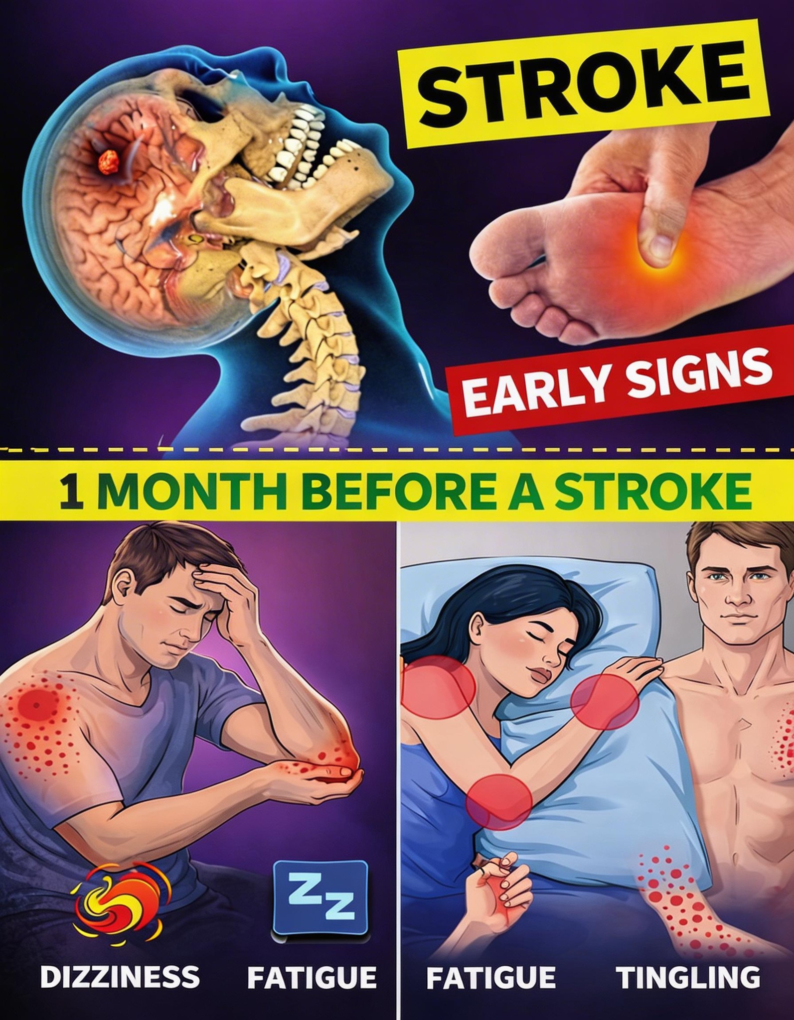 8 Warning Signs of Stroke One Month Before + 9 Powerful Tips to Prevent It