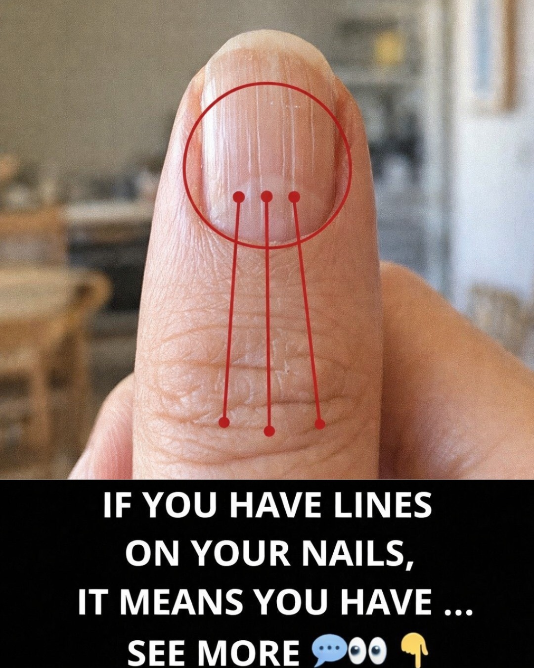 Lines on Your Fingernails: What They Might Reveal About Your Health