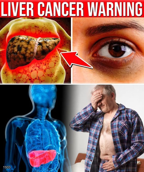 11 Early Liver Cancer Warning Signs You Must Never IGNORE!
