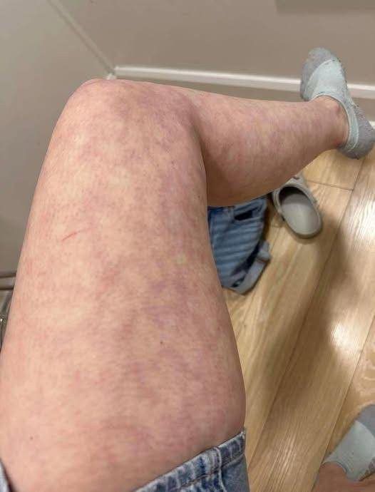 “It Started Overnight”: The Warning Signs She Ignored Until It Got Worse