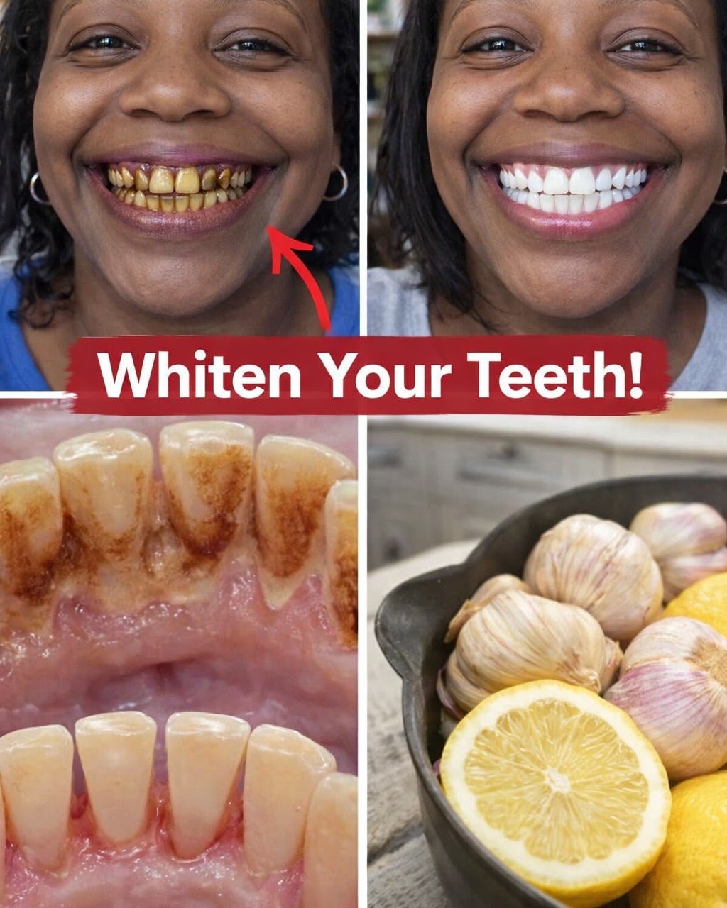 How I Got a Brighter Smile in Minutes with a Simple Home Routine (Live Demo + Tips)