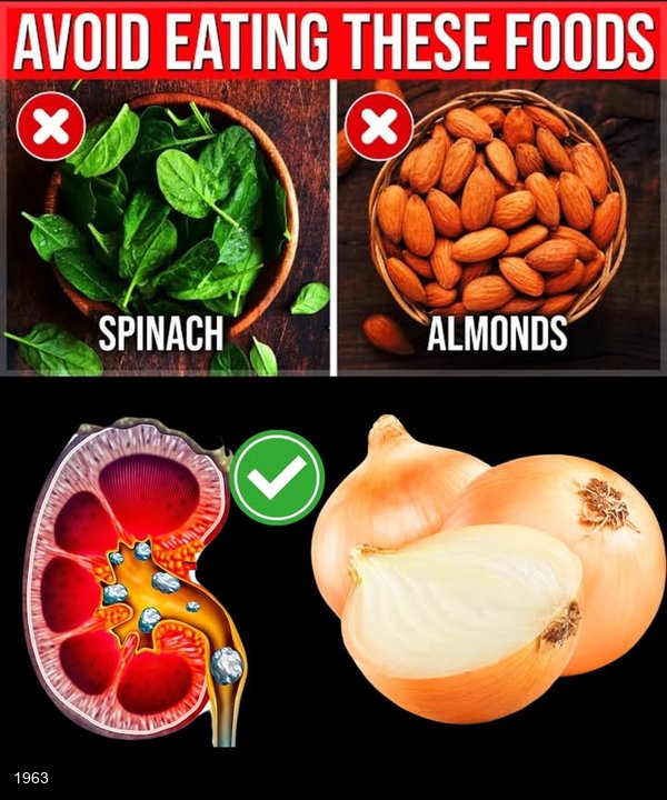 11 High OXALATE Foods That Are Destroying Your Unhealthy KIDNEYS You Must Limit