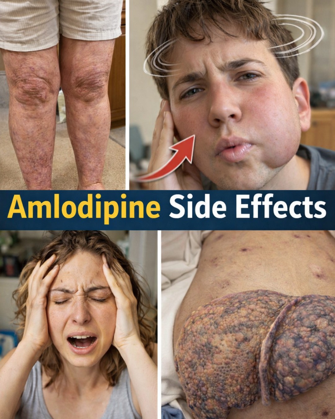 What Are the Top 12 Amlodipine Side Effects Most People Experience (And What Doctors Often Discuss Less Openly)?