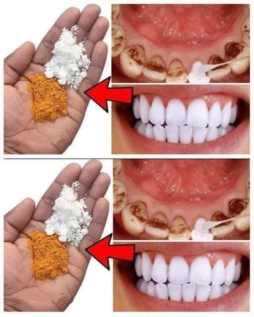 Brighten Your Smile at Home: The 120-Second Natural Secret for Whiter Teeth.
