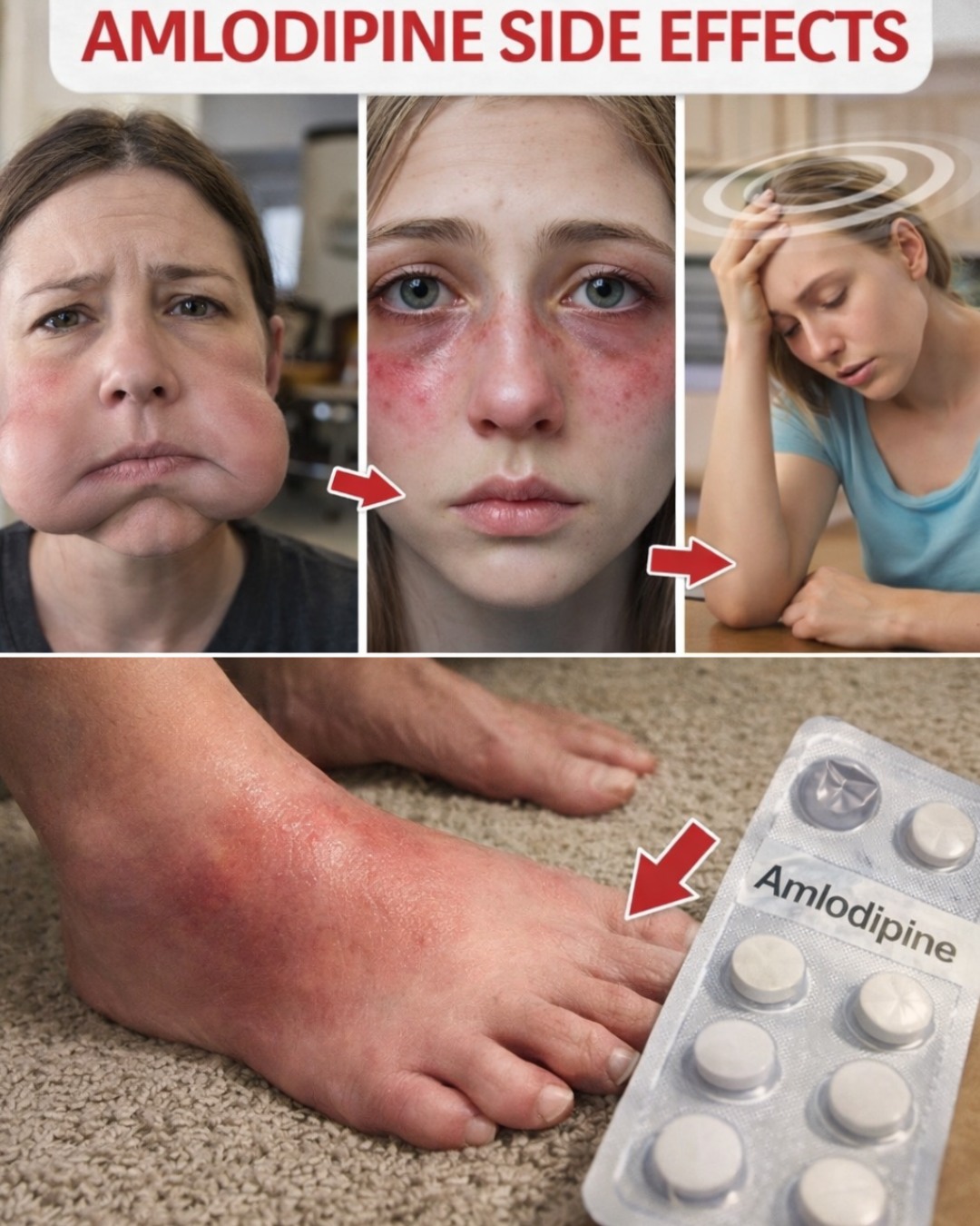 What Are the Most Common Amlodipine Side Effects? 12 Things Worth Knowing Before Your Next Refill