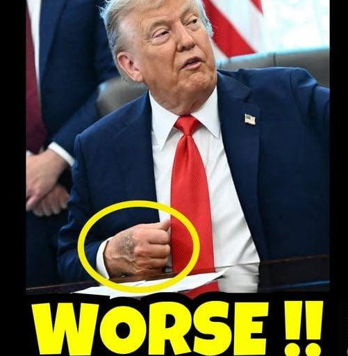BREAKING: Karoline Leavitt confirms President’s new health battle…