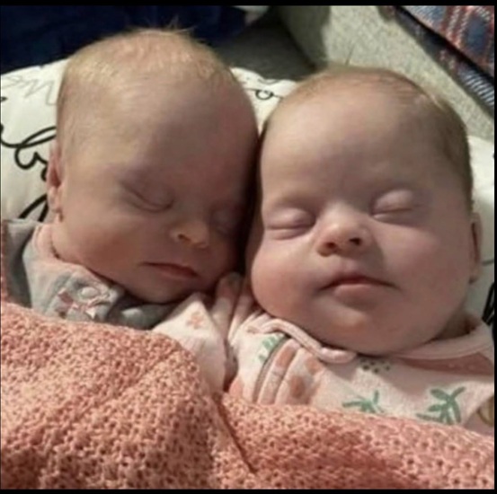 Mother of twins with Down syndrome responds powerfully to online criticism