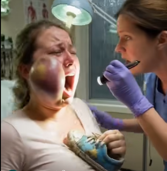 A Heavily Pregnant Woman Stumbled Into My Triage Unit With A Massively Swollen Jaw