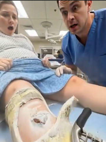 I Was About To Cut A Pregnant Woman’s Strange Leg Cast In The ER